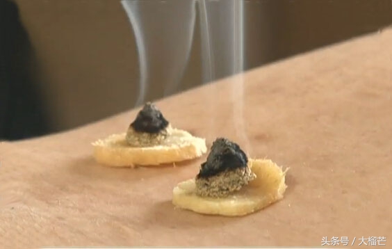 反复过敏性鼻炎没有药怎么处理,多年过敏性鼻炎的治疗方法和禁忌