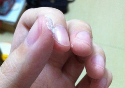 怎么用aa超能胶,aa超能胶如何去掉