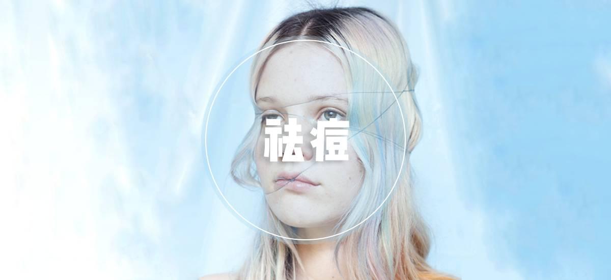 祛痘一步全搞定,怎么祛痘攻略