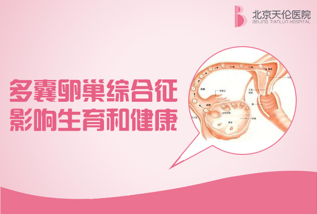 卵巢里暗藏危机？你们知道吗？