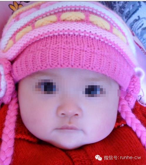 女婴外阴炎怎么造成的,急性幼童外阴炎是什么原因引起的