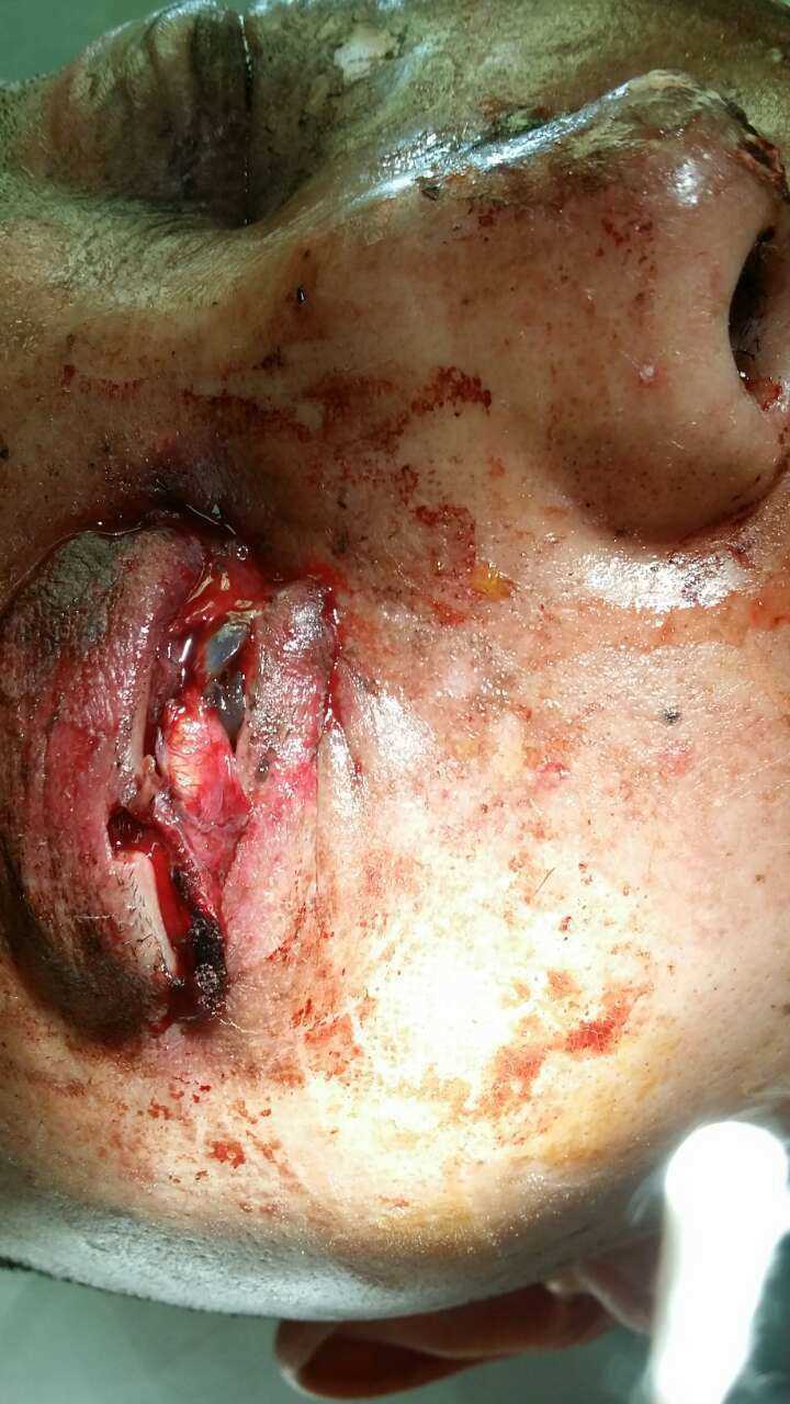 解放军306医院除夕之夜倒计时与正计时