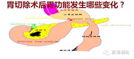 鑳冨垏闄ゆ伅鑲夊悗12灏忔椂楗,鑳冭偁鎭倝鍒囬櫎鍚庝竴鍛ㄥ悗楗