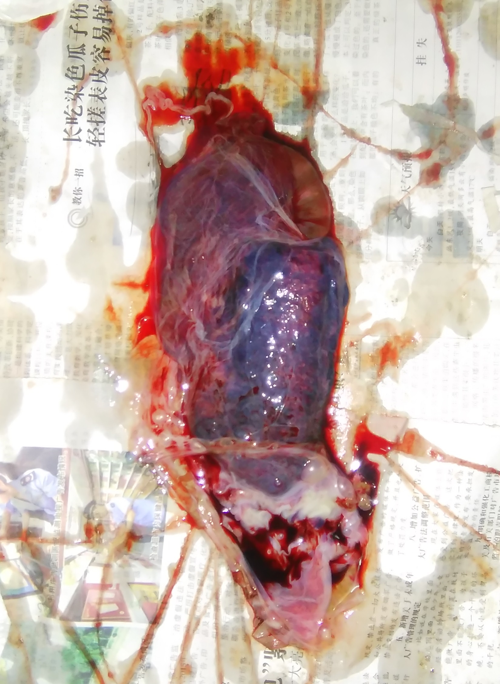 分享产房喜悦,分享产房故事