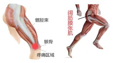 运动后修复膝盖喷雾,膝盖长期运动受损怎么办