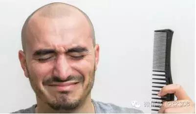 前额头脂溢性脱发最佳治疗方法,头发中间秃了怎么回事脂溢性脱发