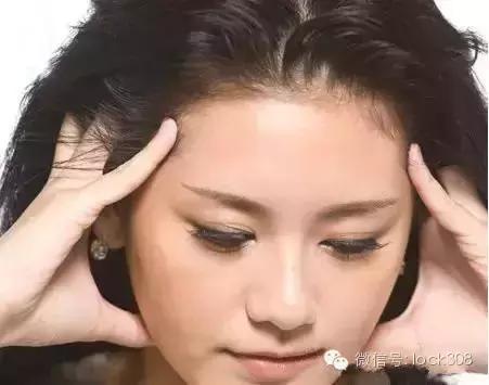 前额头脂溢性脱发最佳治疗方法,头发中间秃了怎么回事脂溢性脱发