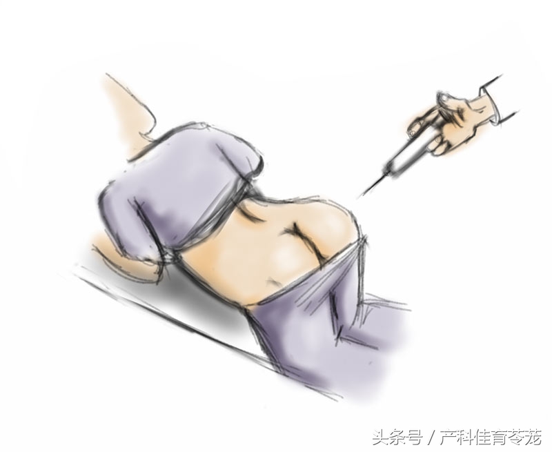 破水了，害怕吗？产科医生教您这样应对