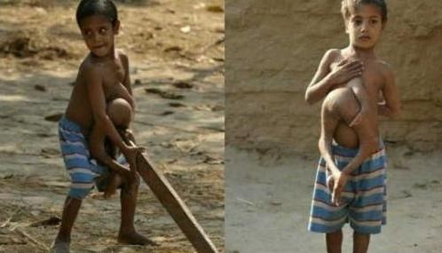 10个不可思议的神奇人类,世界上真实奇怪的人类