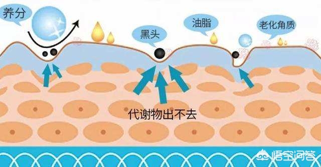 为什么鼻子挤出的白色东西很臭,鼻子上挤出的白色条状物到底是啥