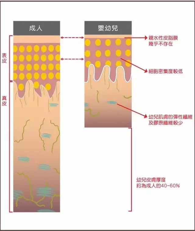 冬天宝宝皮肤干燥怎么保护,宝宝冬天身体皮肤干燥怎么办