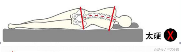 医生说的硬床垫,经常睡硬板床的坏处