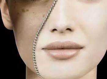 *褐斑黄**是身体内部出了问题!老中医告诉你不同部位长斑的问题?