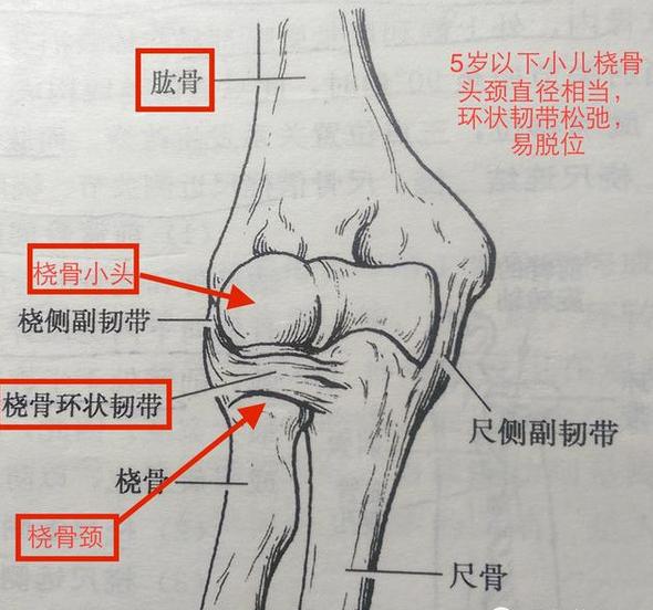 一岁半的宝宝肘关节脱位了怎么办,宝宝肘关节半脱位会影响今后吗