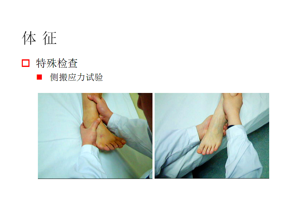 脚崴了怎么办判断是否骨折,脚崴了怎么办视频