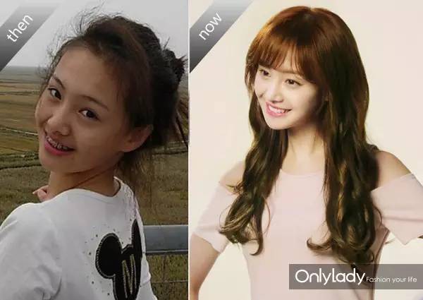 希拉里牙齿怎么样,希拉里的女儿怎么样