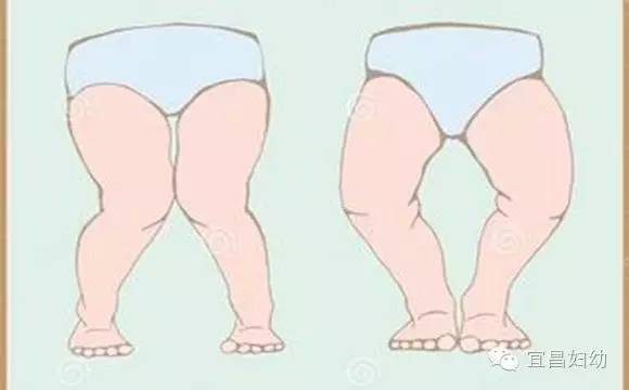 儿童营养与疾病预防的重要性,儿童营养和常见病预防