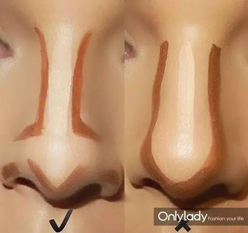 女子花4万块整容把嘴都整歪了,美国女子花76万整容