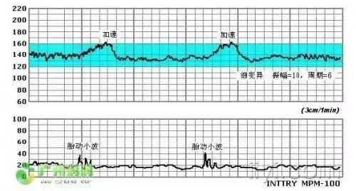 怀孕38周了胎儿还没有入盆正常吗,怀孕38周了还没有生怎么办