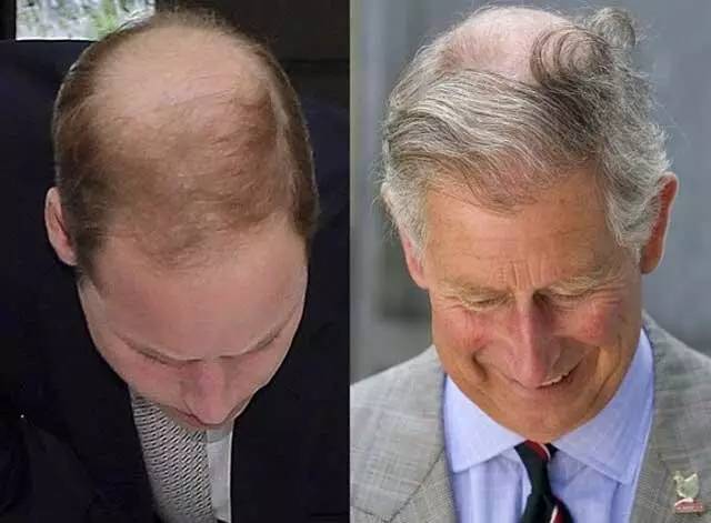 翻牌子｜岁月是支脱毛膏，用对梳子秒变“发海”