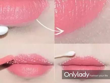 女子花4万块整容把嘴都整歪了,美国女子花76万整容