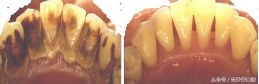 牙医能辨别出换过没换过的牙齿吗,牙医见过最好的牙齿是怎么样的