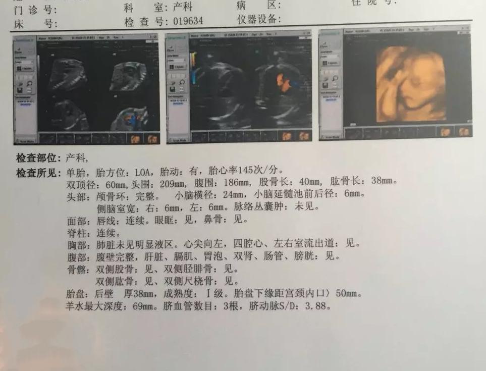 剖宫产后多久再孕,剖宫产十个月后怀二胎