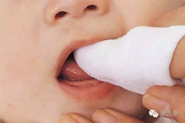 宝宝换牙后牙缝大怎么办,宝宝出牙期牙龈怎么护理