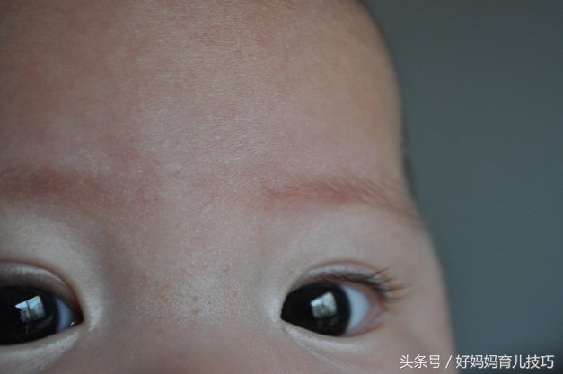 宝宝治疗黄疸期间吐奶,新生儿黄疸10怎么办