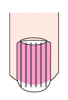 大拇指指甲出现纵纹凸出是什么病,指甲出现黑色的纵纹