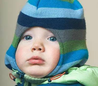 冬天脸红发热是什么原因造成的,宝宝冬天脸红擦什么面霜比较好