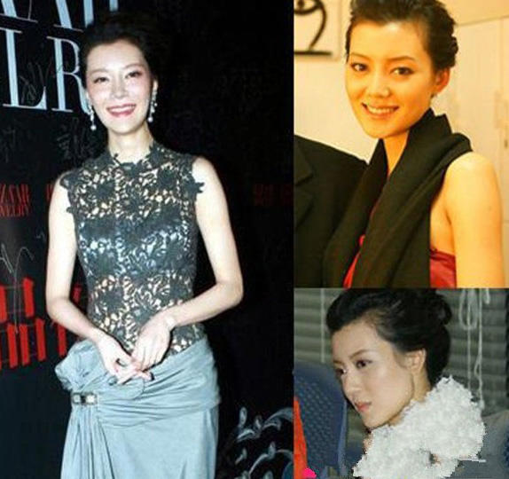 高调嫁首富，分手获三亿补偿，如今整容失败吓坏众人