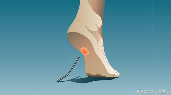 有的鞋走路脚后跟痛怎么回事,走一走就脚痛是鞋的原因吗