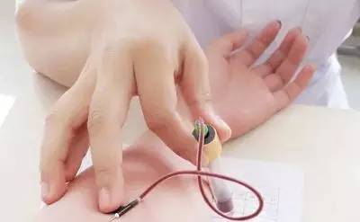 液体活检ctc报销不,肿瘤活检的标本在哪取