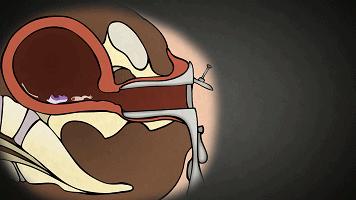 人工流产、药物流产哪种流产更安全？