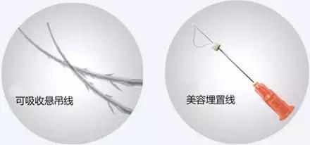 做线雕多久可以敷面膜,敷100次面膜不如打一次水光图片