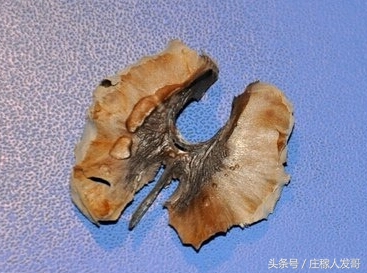 生活中常见的它竟有这些小妙用,这些扔掉的生活垃圾竟然都是宝