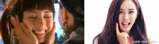 林允整牙效果怎么样,林允整牙后变化图片