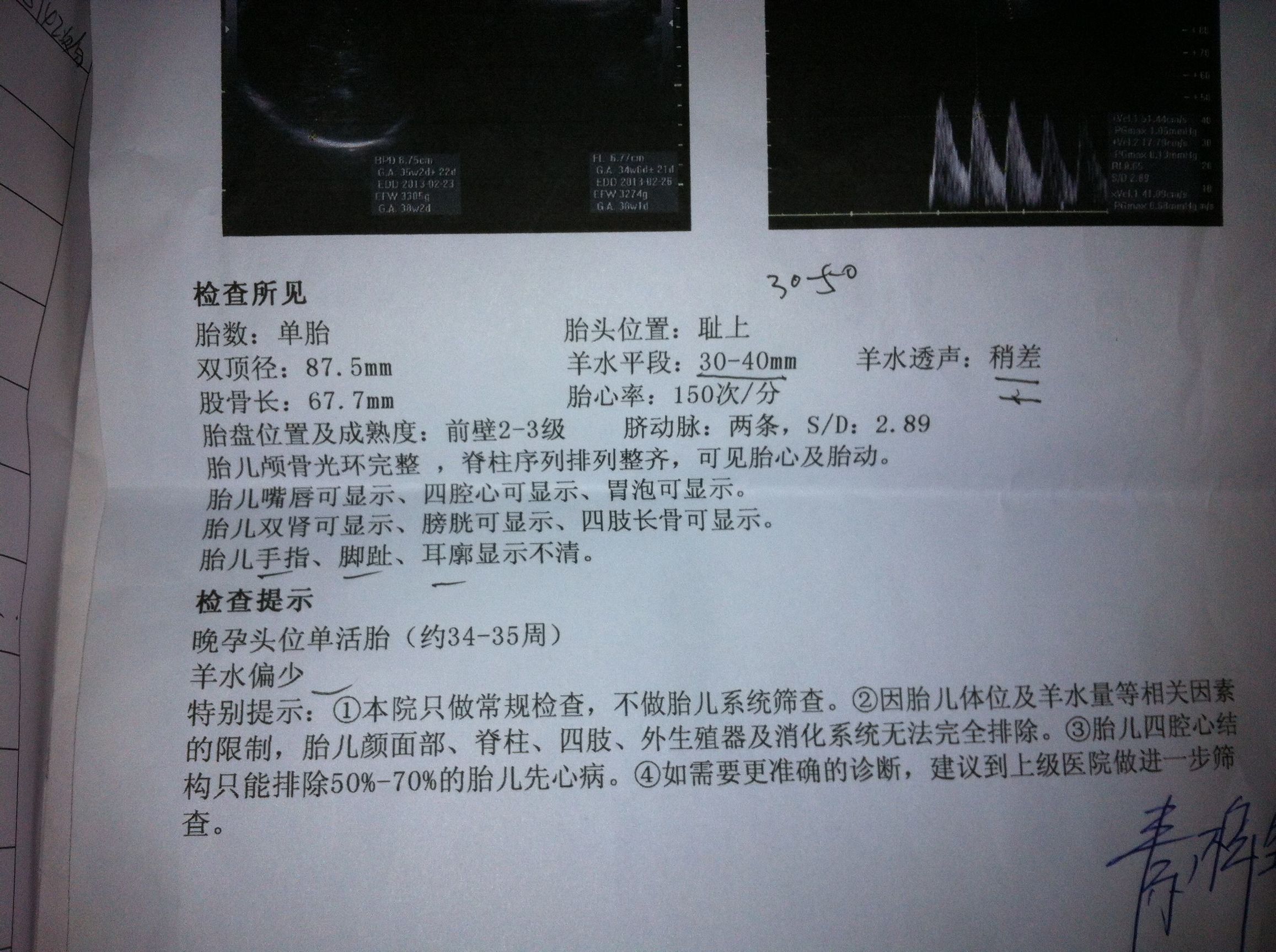 19周b超数据该怎么看,孕妇b超单数据解析