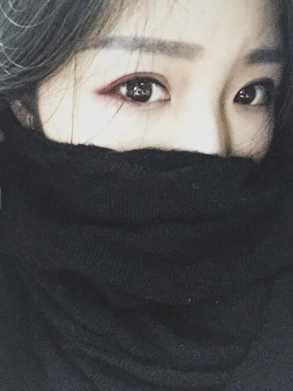 韩式三点双眼皮拆线图片,韩式双眼皮三点好还是五点好