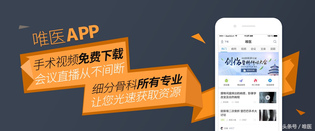 胫骨骨折髓内钉固定怎么锻炼,胫骨骨折髓内钉固定牢固吗