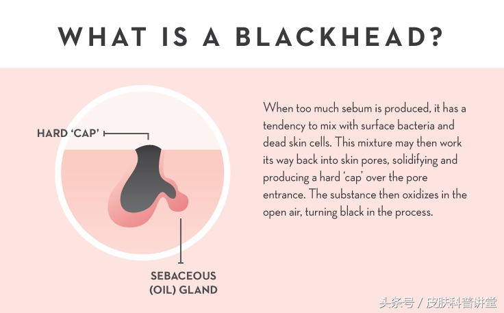 皮肤科医生毛孔粗大推荐的护肤品,毛孔粗大有黑头可以看皮肤科吗