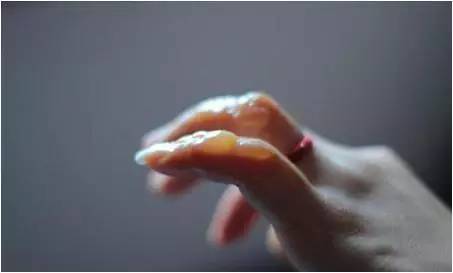 冬天长冻疮的最好方法,冬天治冻疮最好的方法