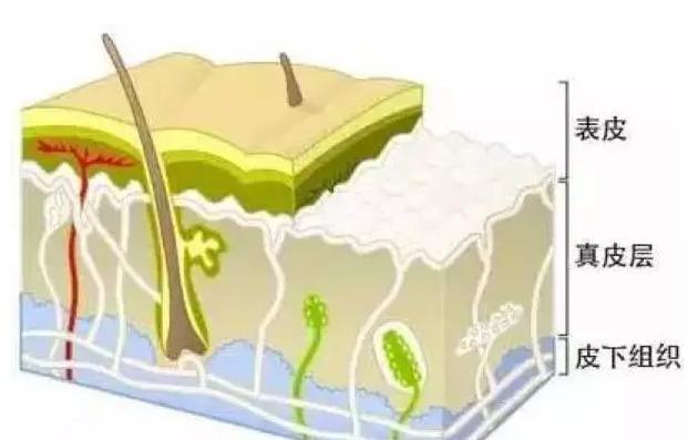 祛痣会引起黑色素瘤,点痣诱发恶性黑色素瘤