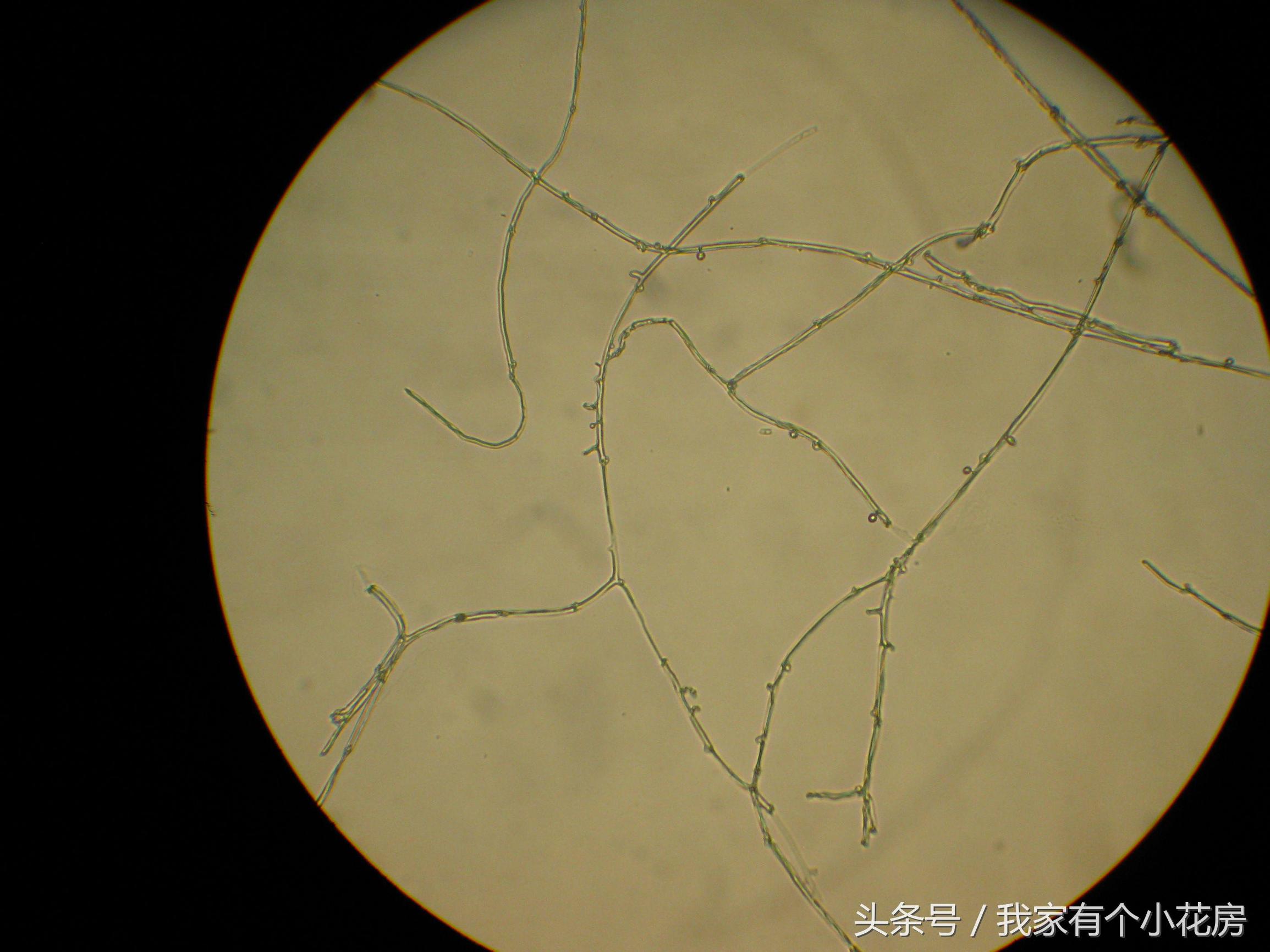 食用菌蘑菇种植技术发展史,食用菌蘑菇叫什么