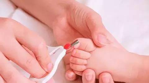 婴儿化脓甲沟炎最简单处理方法,宝宝甲沟炎指甲下有脓