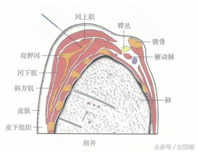 颈肩部疼痛取穴,颈痛穴和腰痛穴