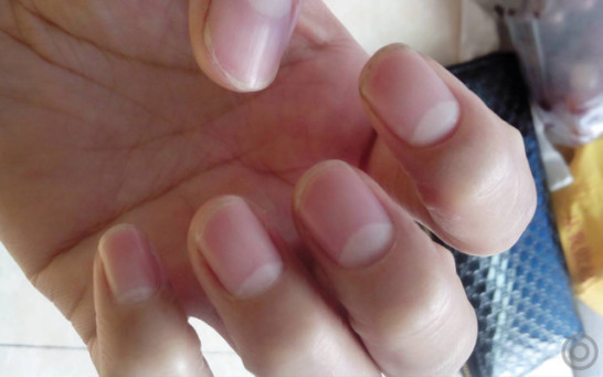 想知道怀孕几率多大,判断自己怀孕最简单的方法