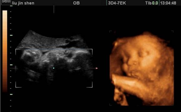 第40周胎儿发育标准,孕第三十五周胎儿的发育情况