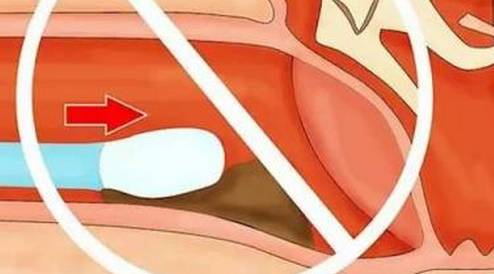 宝宝身上的脏东西洗不掉怎么办,宝宝屎迹怎么去除